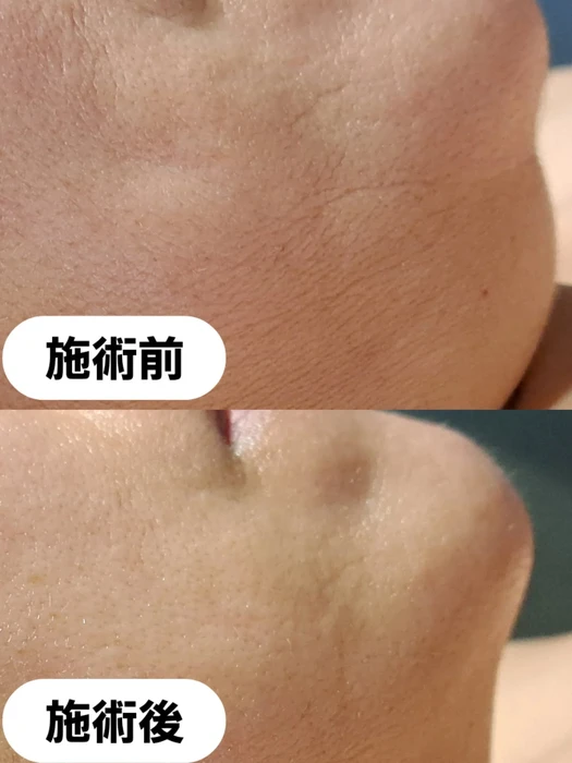画像489