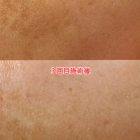 画像490