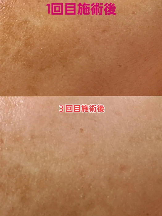 画像490